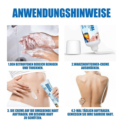WartClean™ | Warzencreme