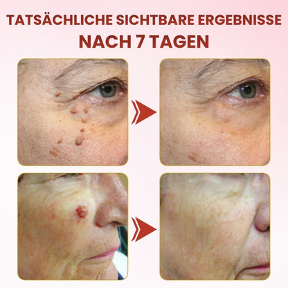 TagGone™ | Schmerzfreie Hautanhängsel-Entfernung mit MicroDart-Pflastern