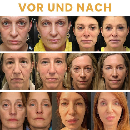 DefyEye™ | Augenserum-Öl-Roller