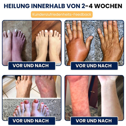 NerviFree™ | Roll-On gegen Nervenschmerzen