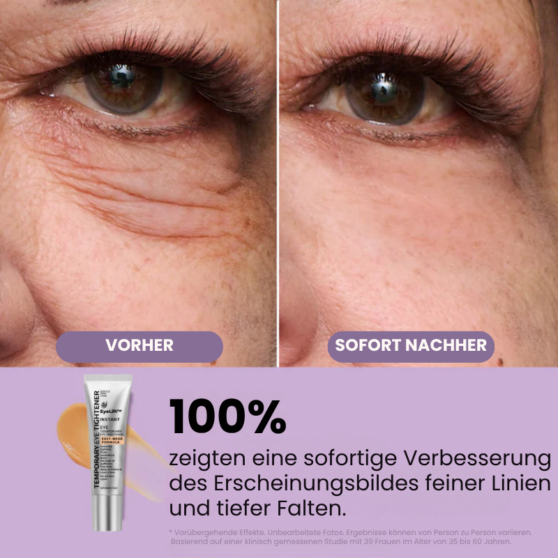 EyeLift™ | Entfernt 98 % aller Augenringe & Falten sofort!
