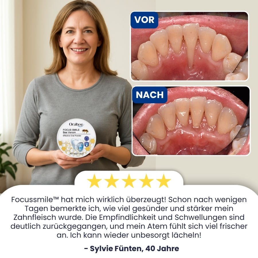 Focussmile™ | Bienengift-Behandlungspulver für den Oralgebrauch