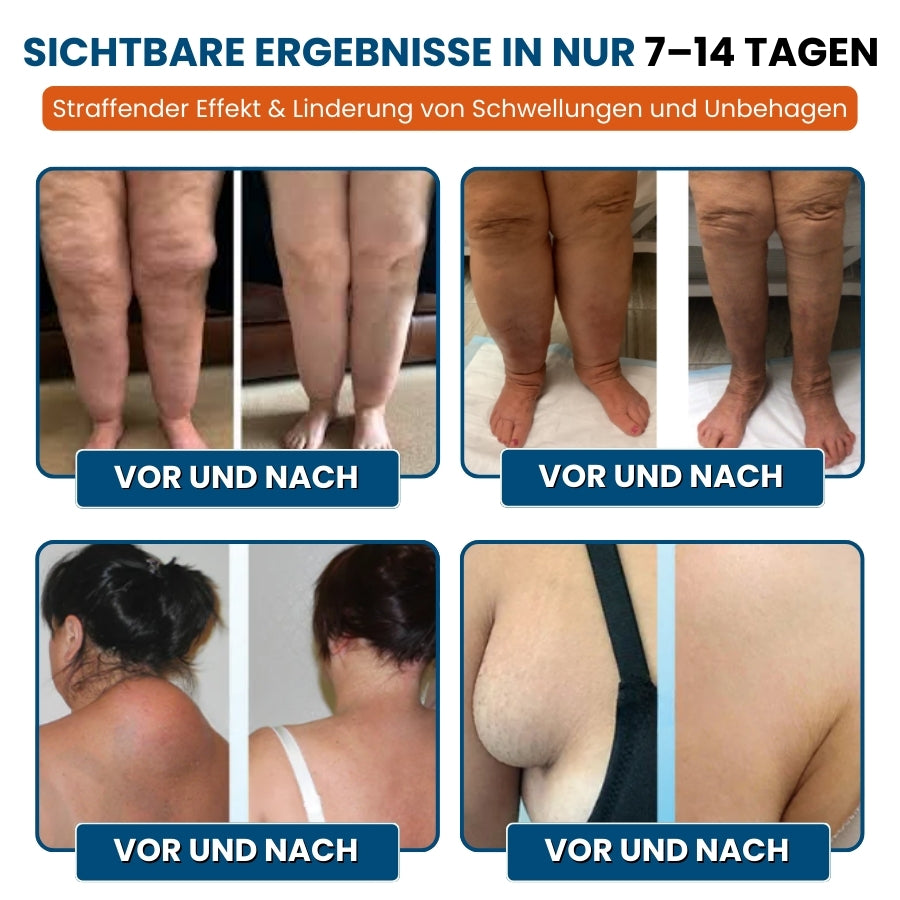 LymphoEase™ | Fühlen Sie sich in nur 14 Tagen leicht, entspannt und frei von Schwellungen