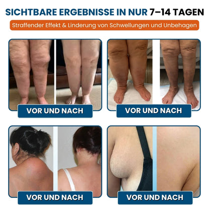 LymphoEase™ | Fühlen Sie sich in nur 14 Tagen leicht, entspannt und frei von Schwellungen