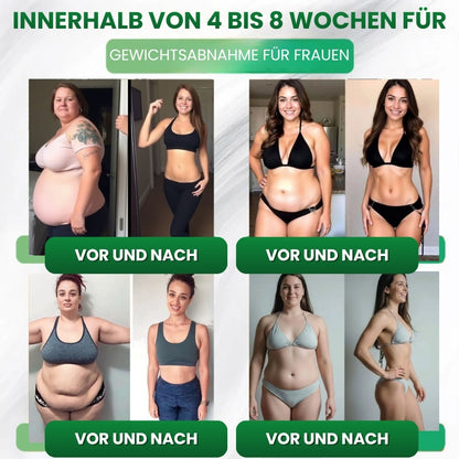 Slimora™ | Fortschrittliches Nano-Mikronadel-Abnehm-Pflaster