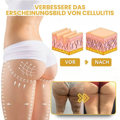 Venomé™ | Botox Faltenstraffende Creme