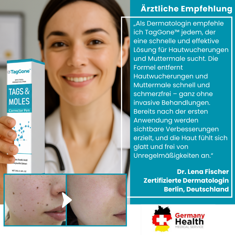 TagGone™ | Tags- und Muttermalentferner