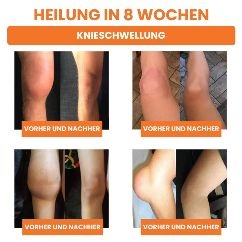 KneeRenew™ | Gelenk-Pflege-Creme