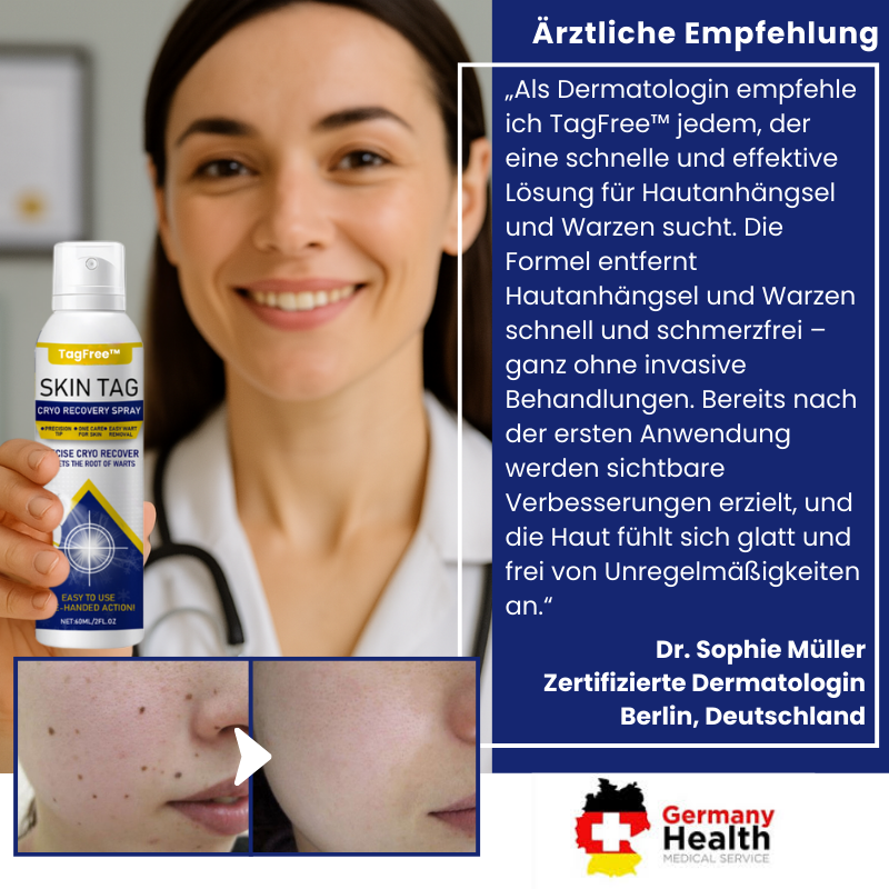TagFree™ | Cryotherapie Hautanhängsel-Entferner-Spray