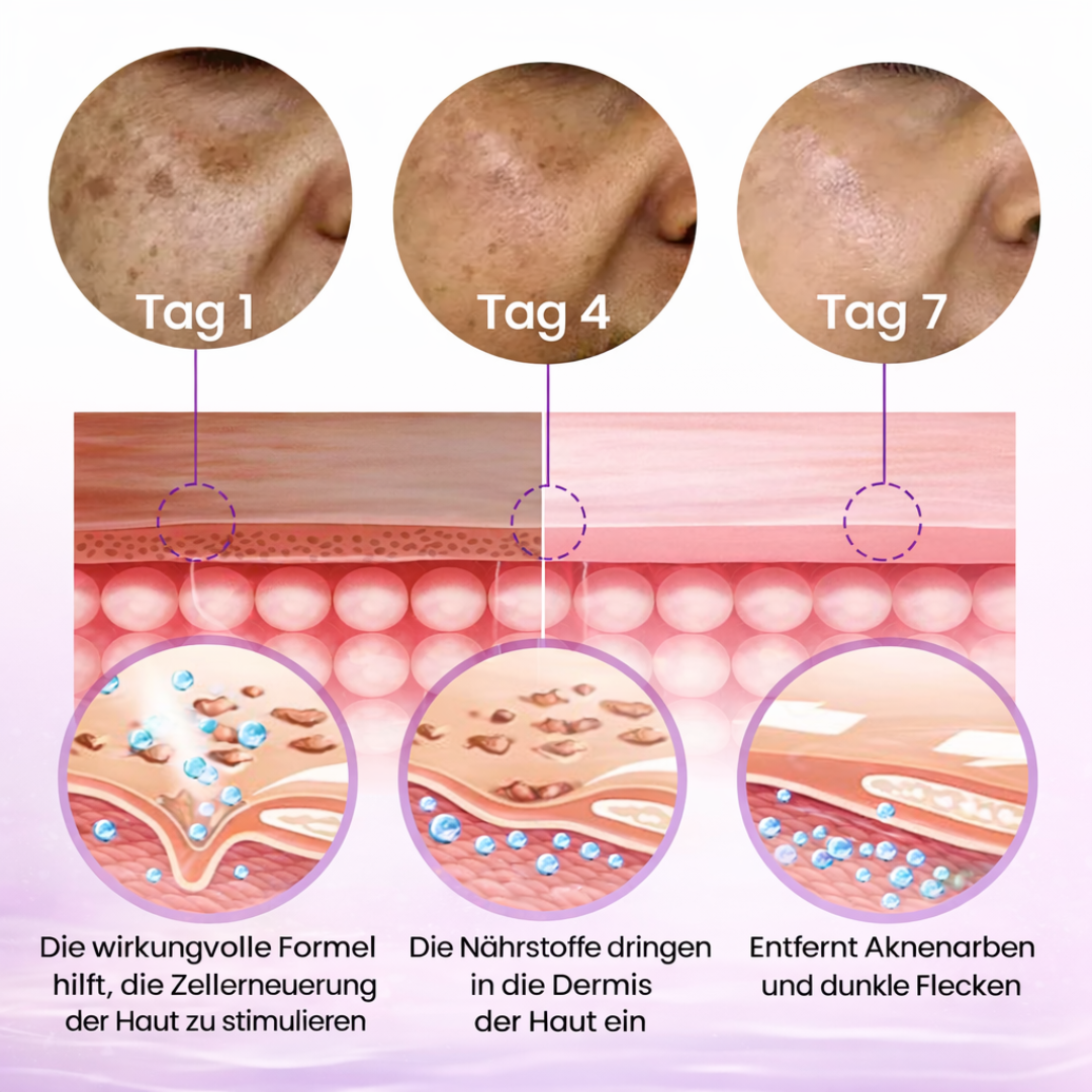 SpotErase™ | Tiefenpflege für das Gesicht