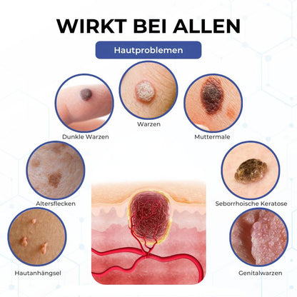 VanishPro™ | Hautpflege zur Entfernung von Hautflecken und Hautanhängseln