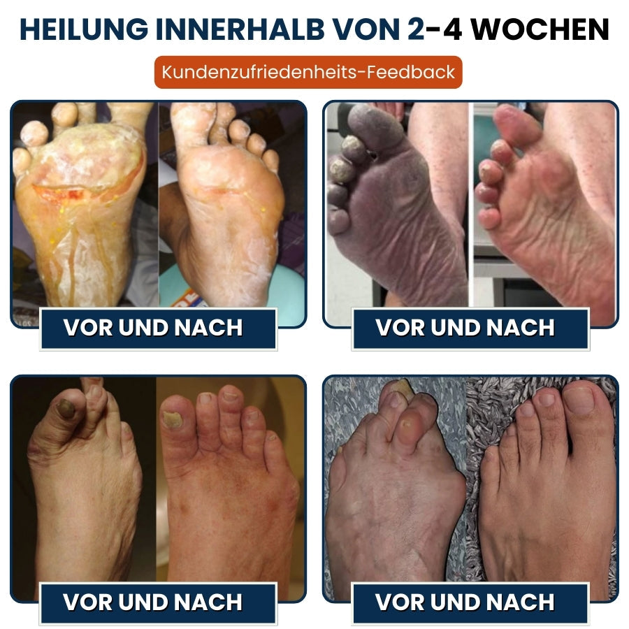 NerveFlex™ | Neuropathie NumbEase Reparaturpflaster