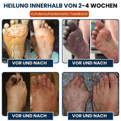 NerveFlex™ | Neuropathie NumbEase Reparaturpflaster