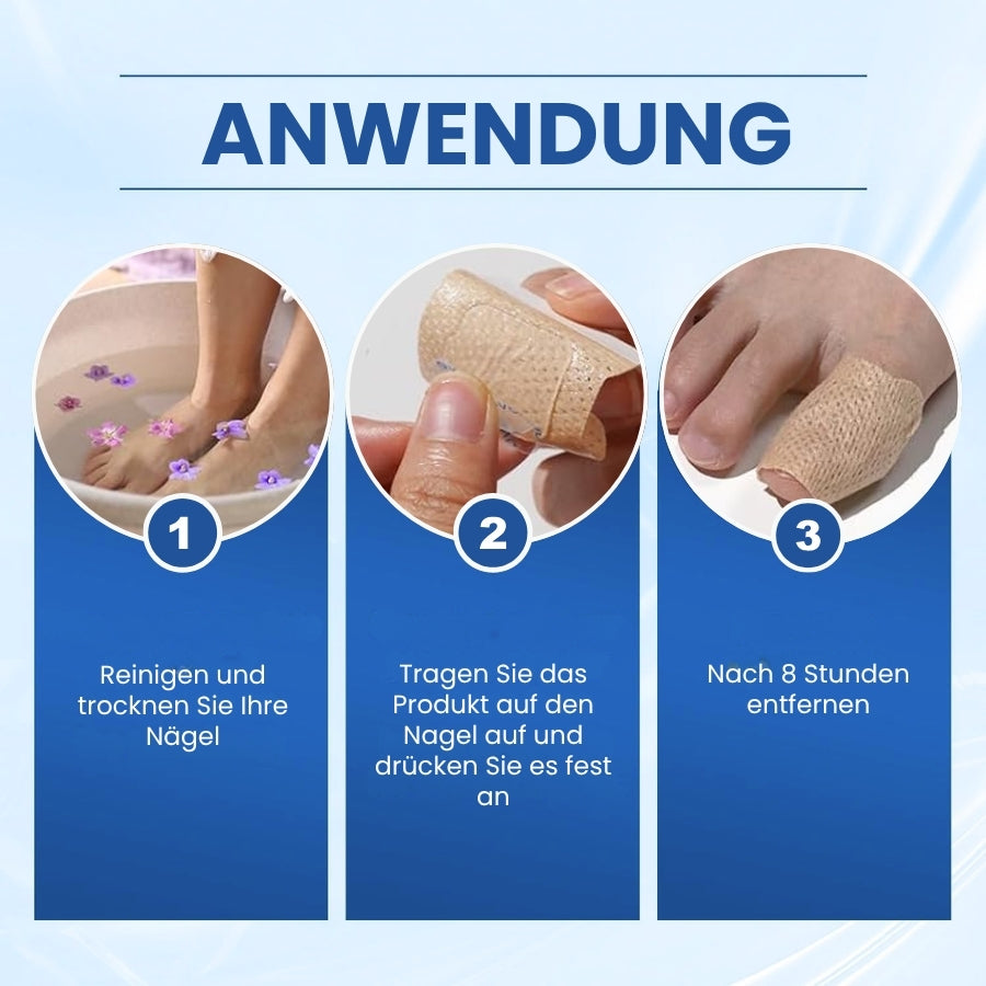 NailRepair™ | Antimykotisches Nagelpflaster
