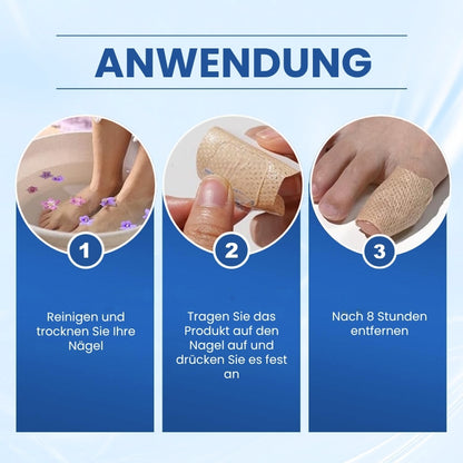 NailRepair™ | Antimykotisches Nagelpflaster