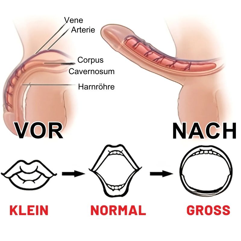 VitaPatch™ | Pflaster gegen Erektionsstörungen