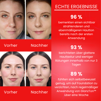 GlanzTon™ | Getönte, farbkorrigierende Gesichtscreme mit Lichtschutzfaktor (SPF)