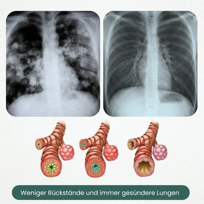 LungRenew™ | Königskerzen-Tropfen zur Unterstützung der Lunge