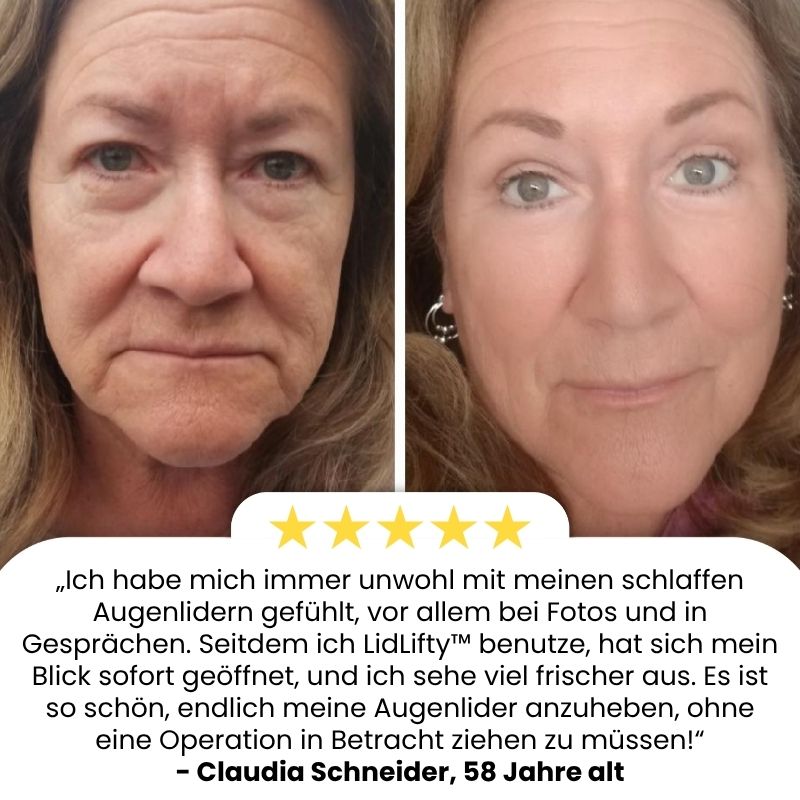 LidLifty™ | Doppelaugenlid-Formungscosmetik