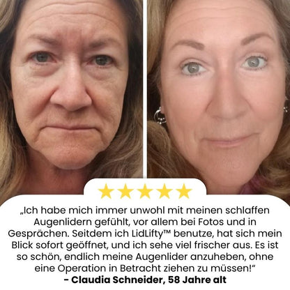 LidLifty™ | Doppelaugenlid-Formungscosmetik