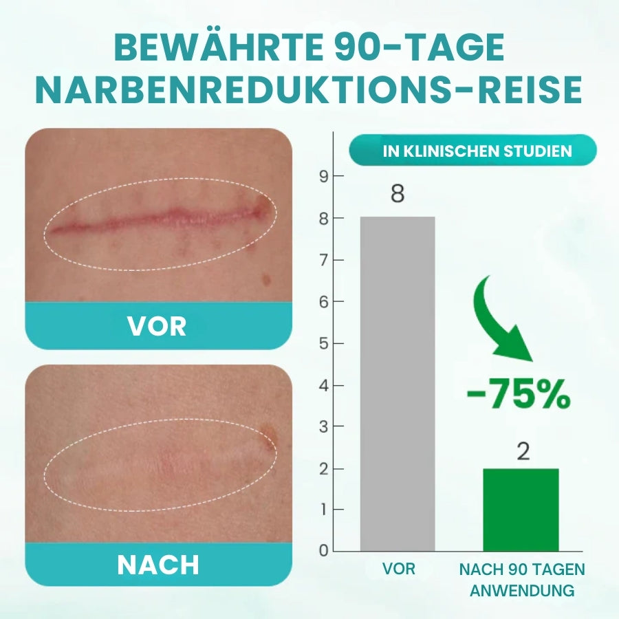 ScarSolve™ | Medizinisches Narbenspray