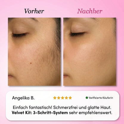 Velvet Kit: 3-Schritt-System