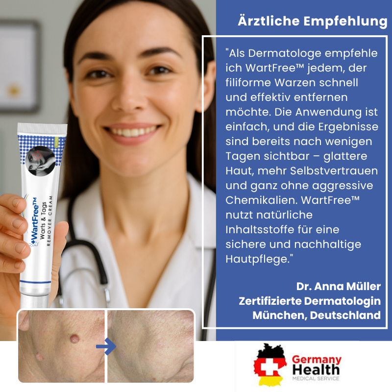 WartFree™ | Lösung zur Entfernung von Stielwarzen