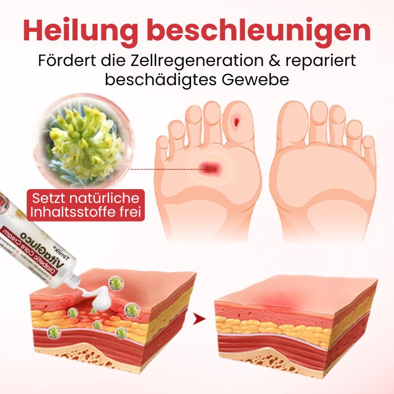 VitaGluco™ | Diabetische Hautreparaturcreme