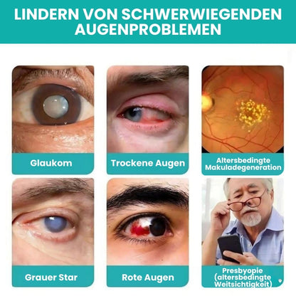 SightRestore™ | Augenroller-Stift