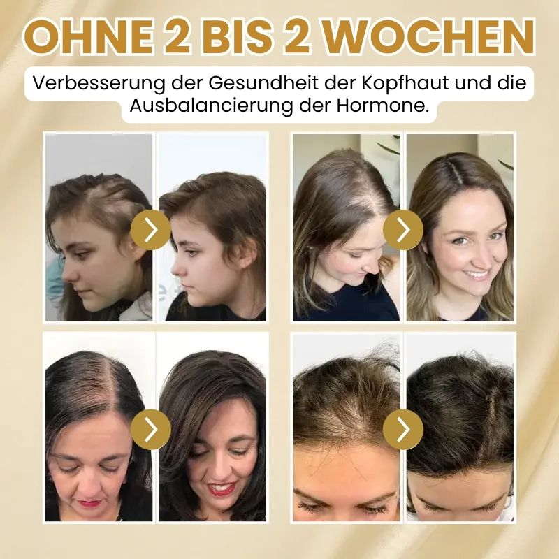 StrandFix™ | Ingwer Haarwuchsserum