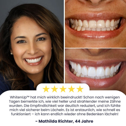 WhitenUp™ | SP-6 Aufhellende Zahnpasta