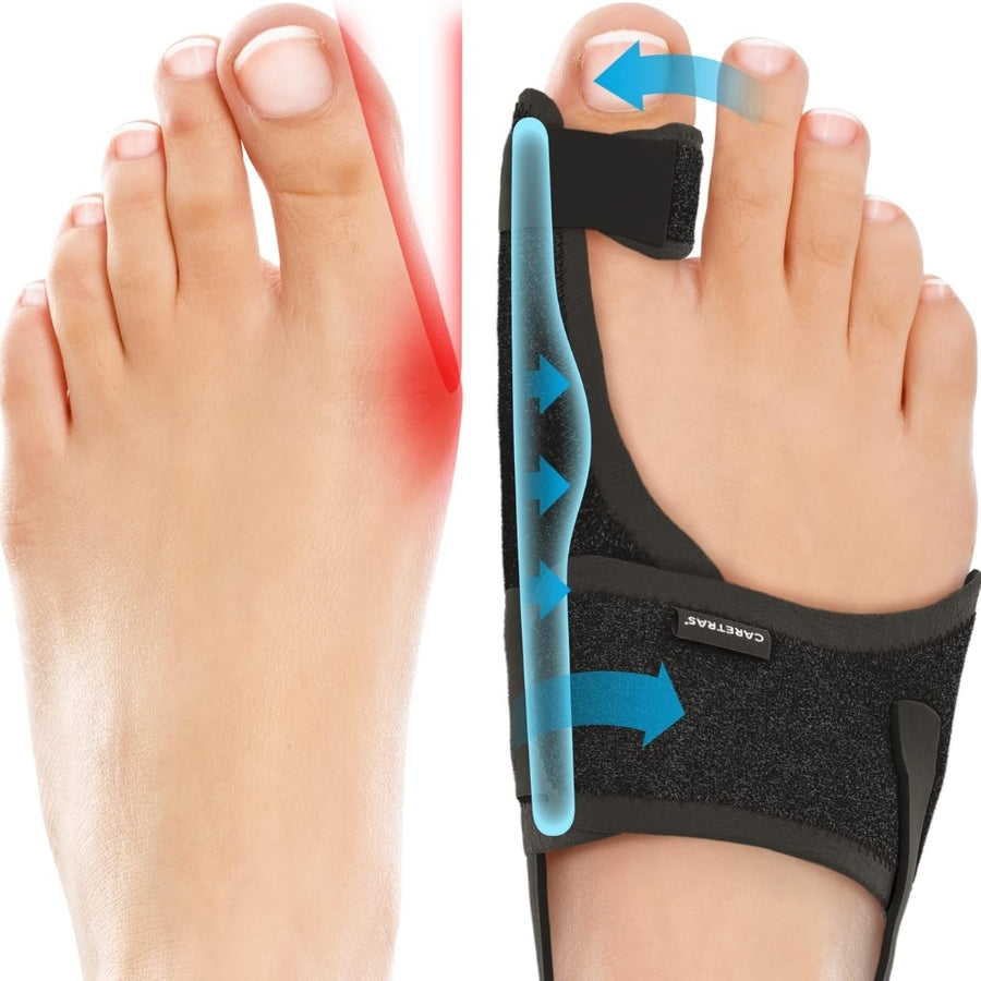 FootFlexi™ | Hallux-Valgus-Entlastungsschiene