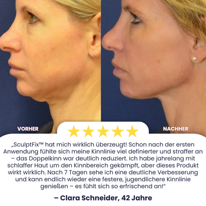 SculptFix™ | Kinnstraffungsmaske