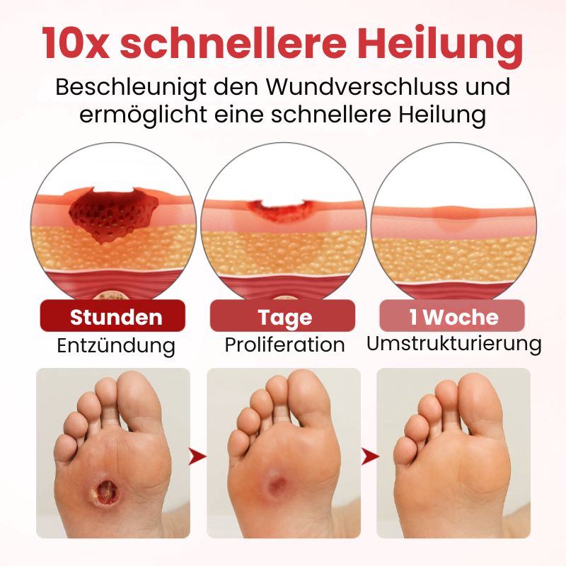 VitaGluco™ | Diabetische Hautreparaturcreme