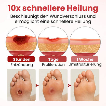 VitaGluco™ | Diabetische Hautreparaturcreme
