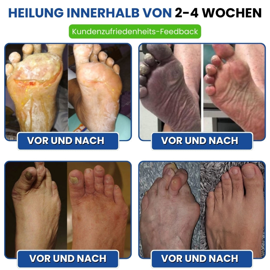 Nurovita™  | Natürlicher Creme für Neuropathie-Komfort