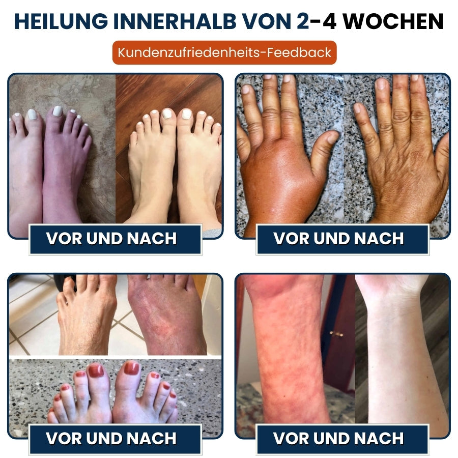 NerveFlex™ | Neuropathie NumbEase Reparaturpflaster