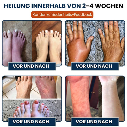 NerveFlex™ | Neuropathie NumbEase Reparaturpflaster