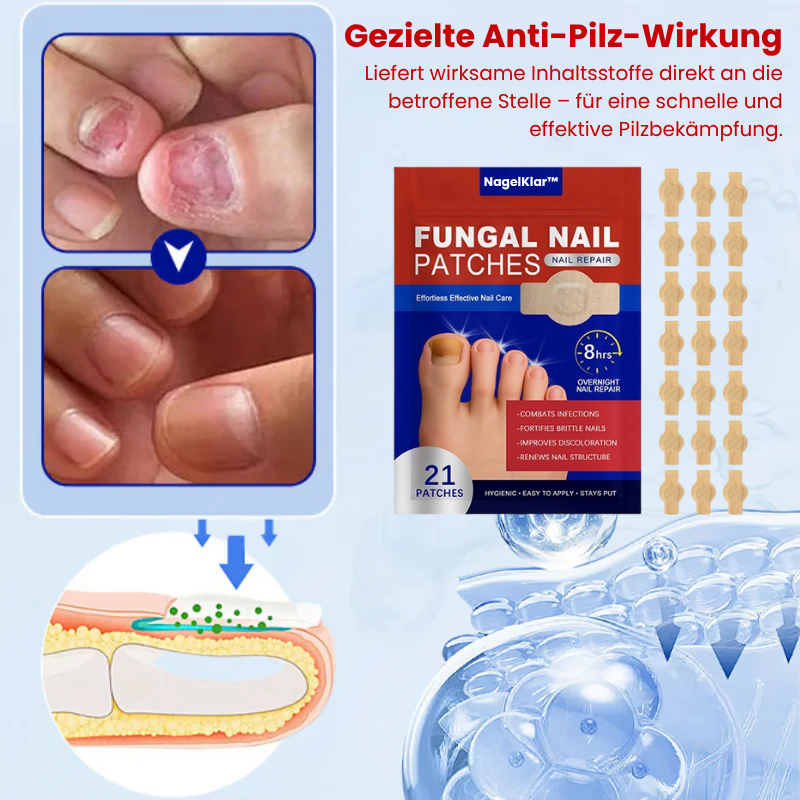 NagelKlar™ | Nagelpilz-Entfernungspflaster