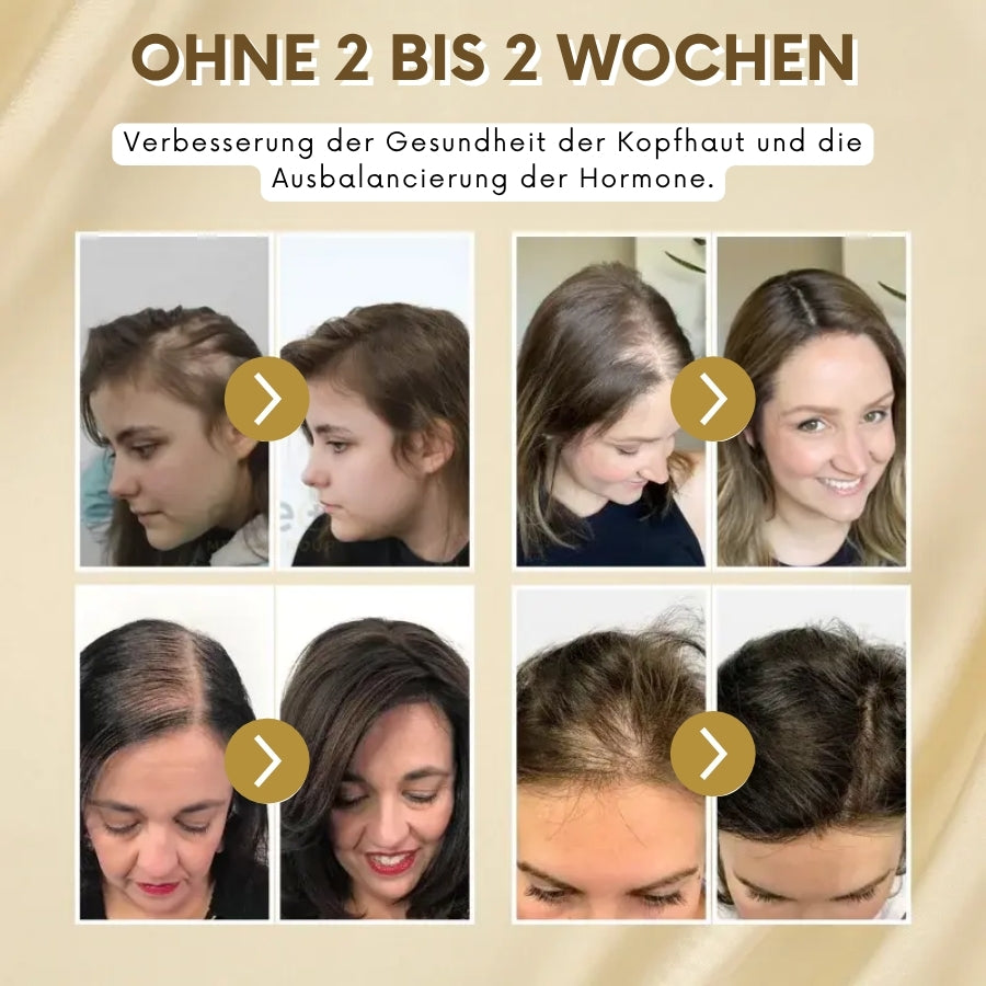 VitaGrow™  | Biotin Haarwuchs-Spray