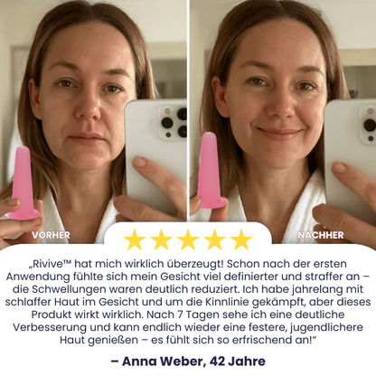 Rivive™ | Manuelle Gesichtskuppung