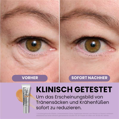 EyeLift™ | Entfernt 98 % aller Augenringe & Falten sofort!