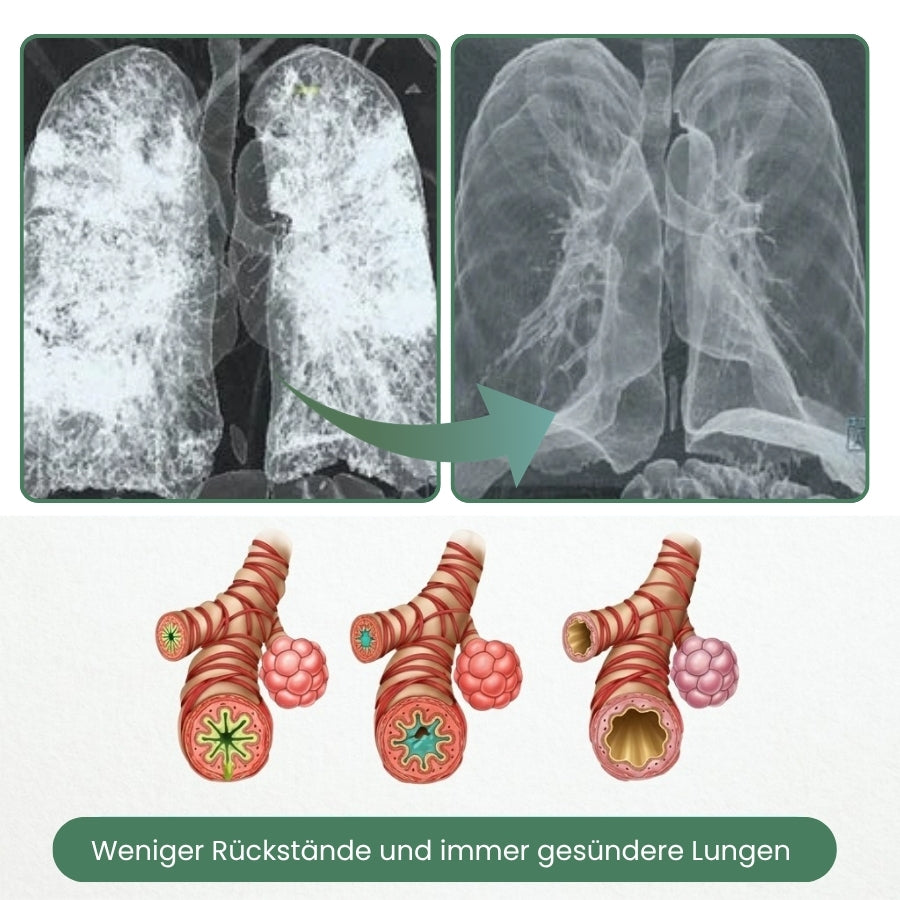 Lungero™ | Pflanzliche Lungentropfen zur Lungenreinigung