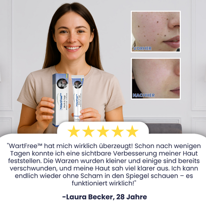 WartFree™ | Lösung zur Entfernung von Stielwarzen