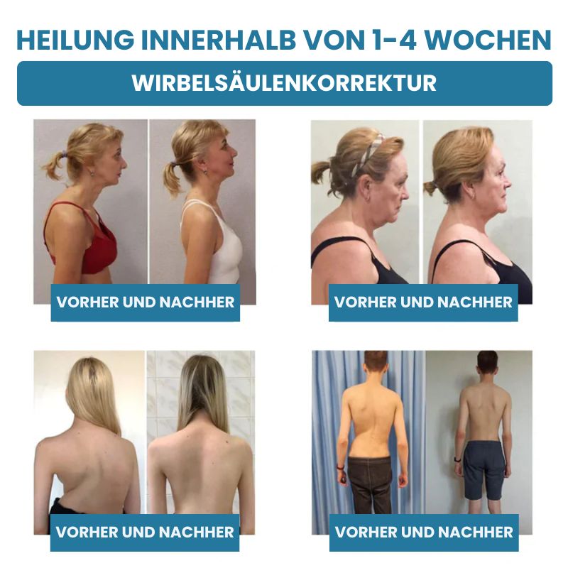 GelenkPro™ | Hyaluron-Creme gegen Gelenkschmerzen