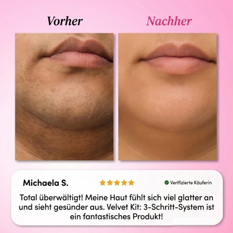 Velvet Kit: 3-Schritt-System