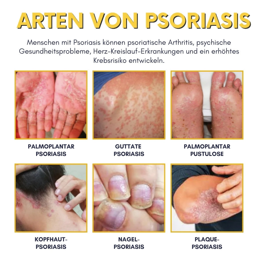 NaturDerm™ | Haut Beruhigende Kräutersalbe