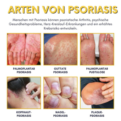 NaturDerm™ | Haut Beruhigende Kräutersalbe