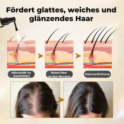 CollagenGrow™ | Haarwuchsspray