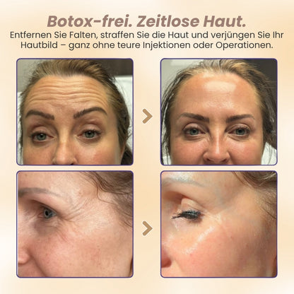 DermaPure™ | 15-Stunden-Lifting für das Gesicht